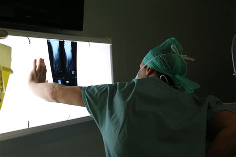 Hallux Valgus Dr Jean Baptiste Gross Chirurgie Mini Invasive Et Percutan E Du Pied Et De La