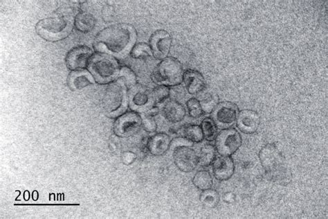 An Electron Micrograph Of Extracellular Vesicles Courtesy Of Maija