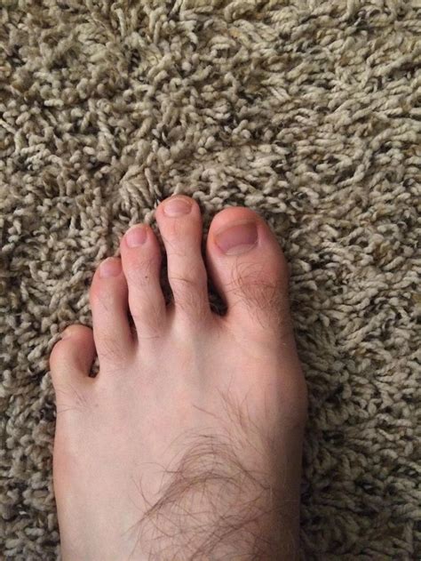 My Second Toe Is Longer Than My Big Toe Which Is Known As Morton S Toe
