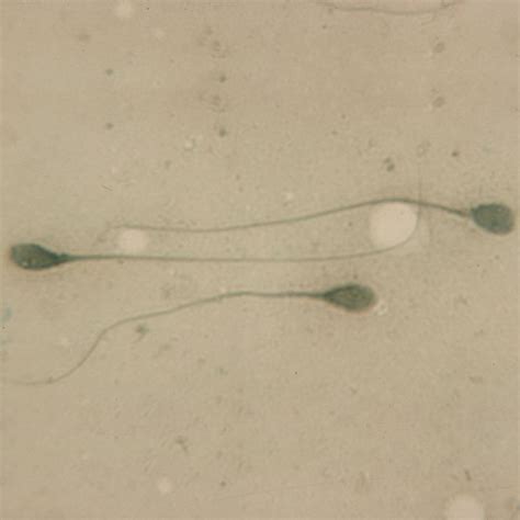 Human Sperm Slide Smear