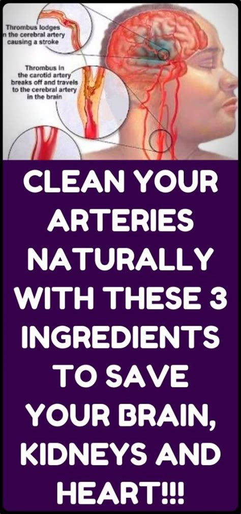 how to clean out plaque in arteries 3 ingredients mixture arterycleaning in 2020 clean