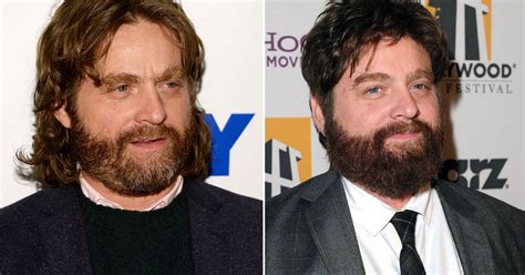 Zach Galifianakis Slims Down Shows Off Weight Loss On Tonight