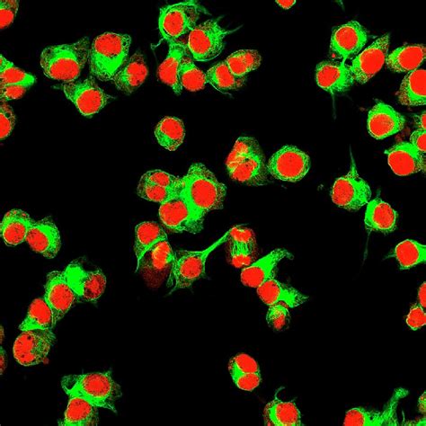 Neuroblastoma Cells Photograph By Vshyukova Science Photo Library
