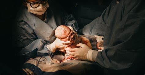 Awareness of your changing body. Woman Giving Birth to Baby Via C-section · Free Stock Photo
