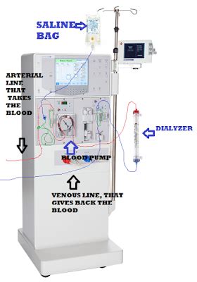 Learn how the 2008t bluestar can provide your clinic with labor and cost the 2008t bluestar hemodialysis machine is designed to potentially provide: 7 QUICK STEPS TO SETTING UP A K, K2 FRESENIUS MACHINE | *Dialysis Technicians USA* DTechsUSA.com