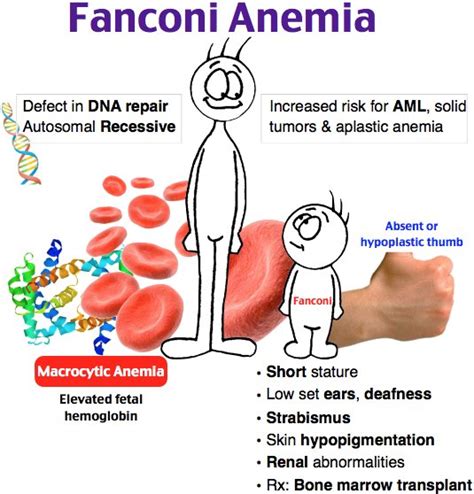 Rosh Review's Adam Rosh on Twitter: "What type of anemia ...