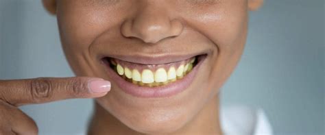 What Causes Yellow Teeth And Discolouration Pepsodent