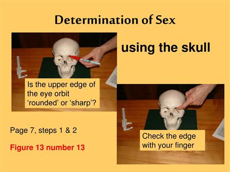 ppt determination of sex powerpoint presentation free download id 6450144