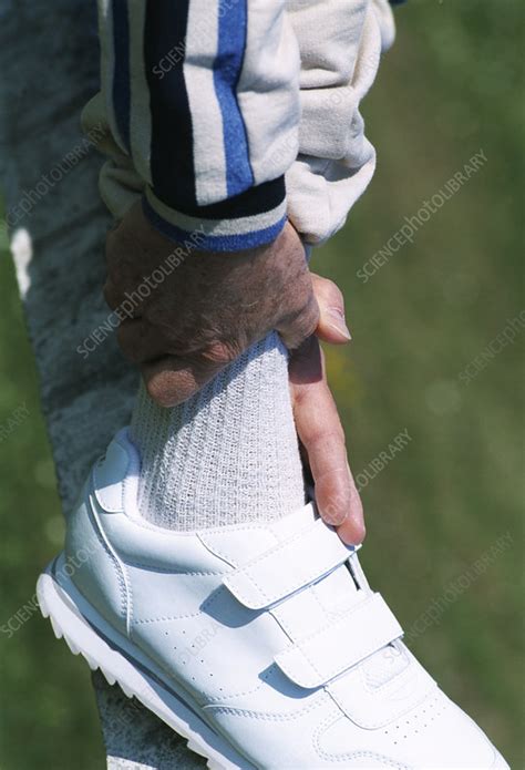 Sprained Ankle Stock Image M3820407 Science Photo Library