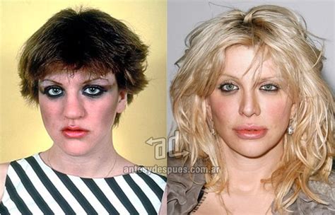 Celebrities With Plastic Surgery Before And After Photos Biography And Family Bad