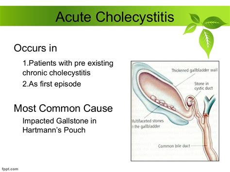 Acute And Chronic Cholecystitis