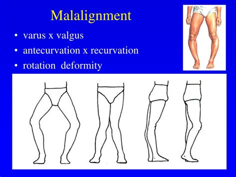 Ppt Clinical Examination In Orthopaedics Powerpoint Presentation