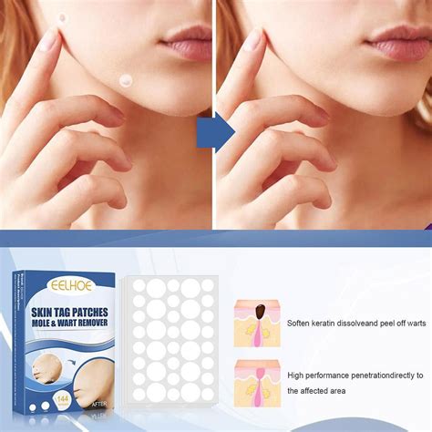 144pcs Acne Wart Remover Pimple Wart Treatment Patch Hydrocolloid Gel