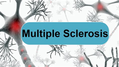 multiple sclerosis symptoms causes and treatment