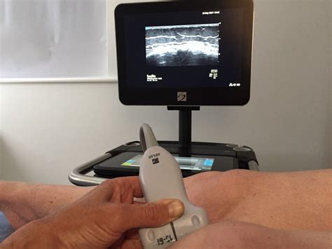 Ultrasound Scan Yorkshire Orthopaedic Solutions