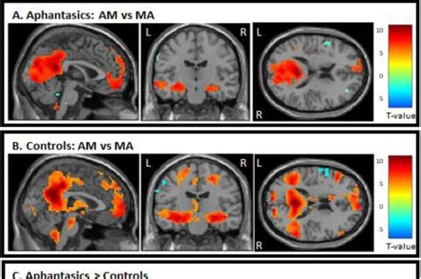 Researchers Find Connection Between Autobiographical Memory And Aphantasia