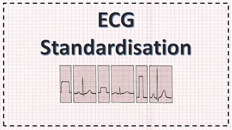 Ecg Paper And Standardisation Ecg Interpretation Basics Simplified
