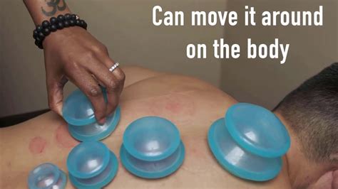 Edge Cupping Therapy Set By Lure Essentials Benefits Of Cupping And