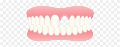 Missing Teeth Clip Art