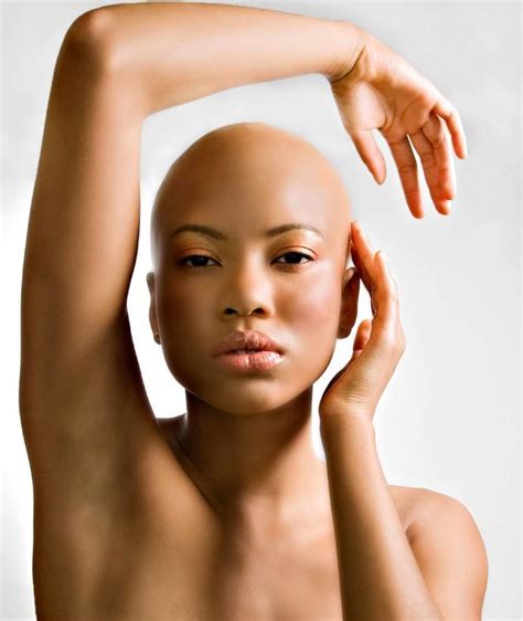 Pin On Alopecia Culture