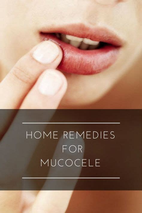 Top 12 Home Remedies To Get Rid Of Mucocele Home Remedies Remedies