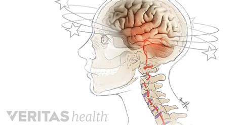 Can Neck Pain Cause Dizziness