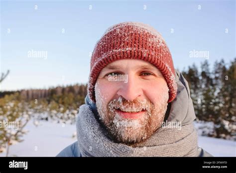 Face Covered With Snow Hi Res Stock Photography And Images Alamy