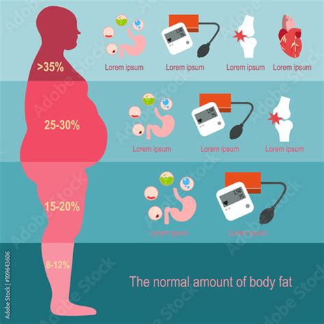 Obesity Man The Degree Of Obesity Vector Illustration The