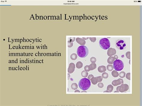 Abnormal Lymphocytes Medical Laboratory Science Laboratory Science