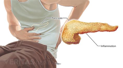 Lower Back Pain Internal Organs Female Lower Back Anatomy Internal