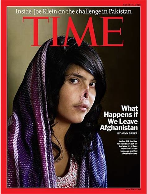 Disfigured Afghan Womans Image On Time Cover Wins World Press Photo Of