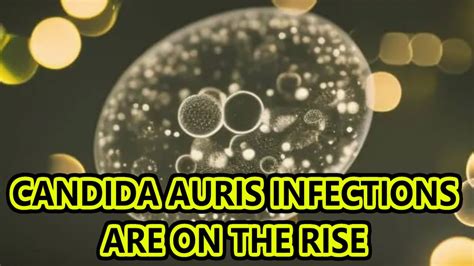 Candida Auris Infections On The Rise Youtube