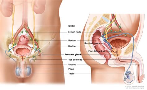 Here are some of the tests you may need: Prostate Cancer Treatment (PDQ®) (Patients) - Siteman ...