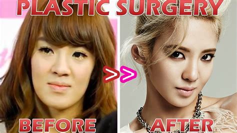 Korean Idol Plastic Surgery Telegraph