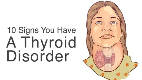 What Causes Thyroid Problems Drbeckmann