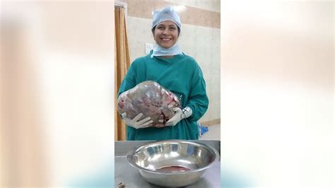 Graphic Image Warning Doctors Find 26 Pound Tumor Inside Pregnant