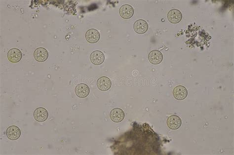 Entamoeba Coli Cysts Stage In Stool Exam Stock Image Image Of