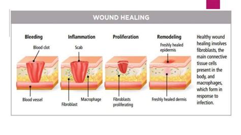Types Of Wounds And Management