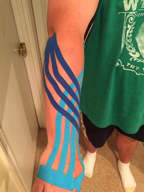 Faq Kinesiology Taping For Lymphedema Lymphie Strong