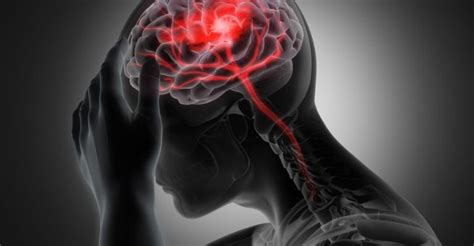 Stroke Surgery When And Which Procedure Is Best