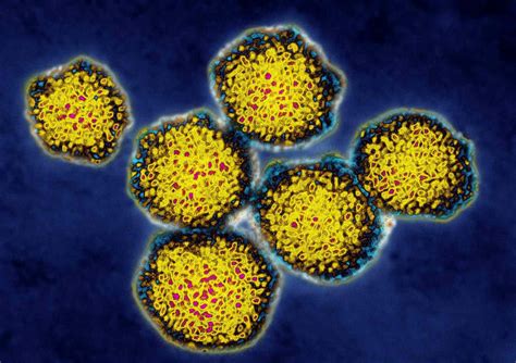 ¿qué Es Una Carga Viral Para La Hepatitis C Medicina Básica