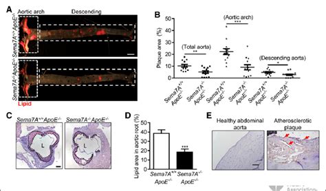 Sema7a Semaphorin 7a Deletion Reduces Lipid Deposition In The Aorta