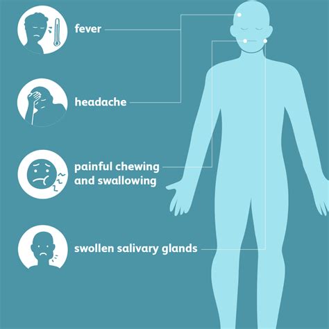 Mumps Signs Symptoms And Complications