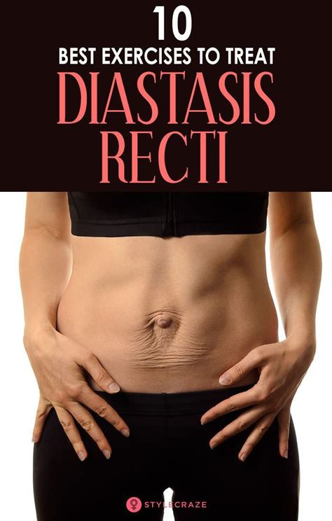 Best Diastasis Recti Exercises You Can Do At Home To Strengthen Your