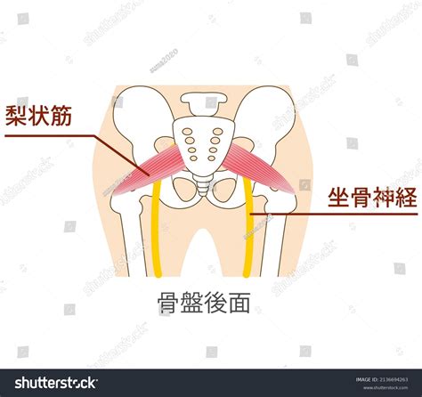 Illustration Piriformis Sciatic Nerve Translation Positional Vetor Stock Livre De Direitos