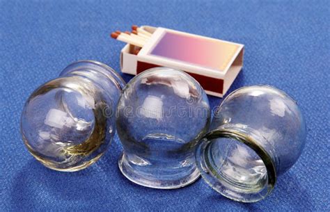 Cupping Glass Stock Image Image Of Equipment Back 30985987