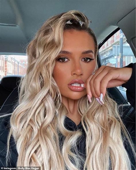 Molly Mae Hague Continues To Show Off Results Of Dissolved Lip Filler Hot Lifestyle News