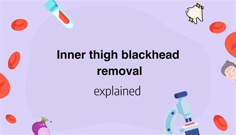 Inner Thigh Blackhead Removal