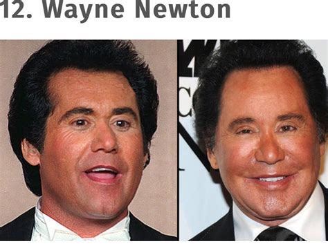 Pin by Carmen Lydia on Before and after | Plastic surgery ...