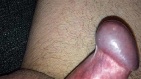 My Foreskin Pulled Back 2 Free Solo Man Porn 4e Xhamster
